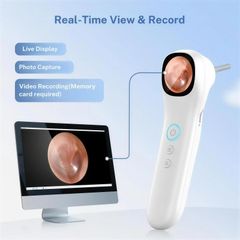 The built-in screen showing a live ear-canal view alongside a desktop display